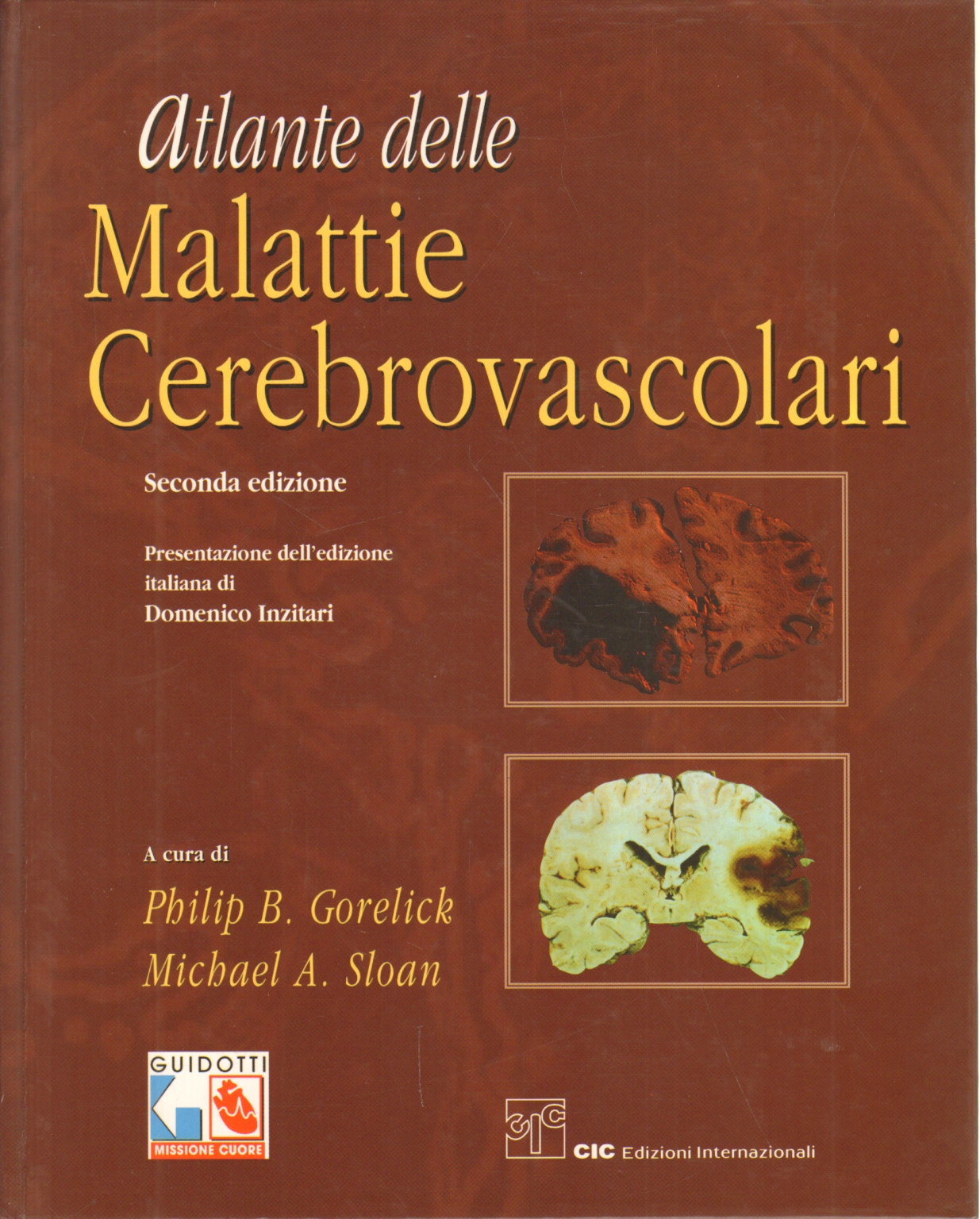 Atlas de la maladie cérébro-vasculaire, Philip B. Gorelick et Michael A. Sloan